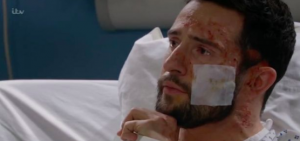 Ross Barton scarred acid attack