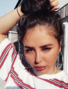 Marnie Simpson after nose job (Credit: Instagram)