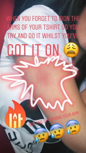 Brooke Vincent burning herself on an iron