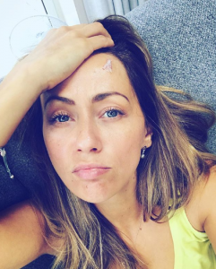 Samia Longchambon got butterfly sstitches after son injured head