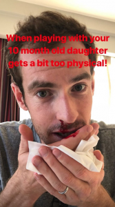 Andy Murray injured by daughter