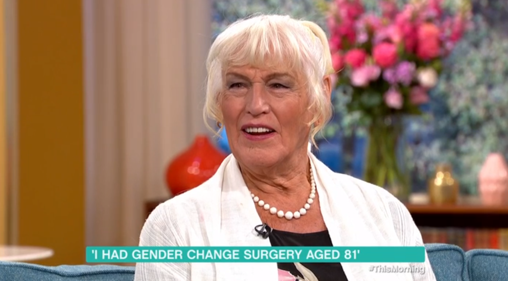 Woman has gender reassignment surgery at 81 Entertainment Daily