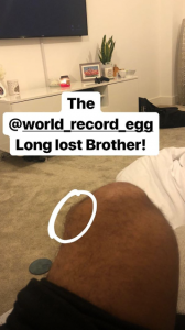 Wes Nelson suffers injury on DOI