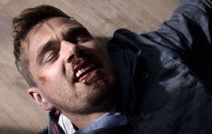 Iain was left bloodied after a bar brawl in Casualty (Credit: BBC)