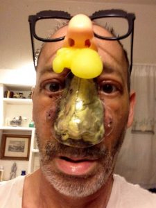 Steve Bean dies of nose cancer