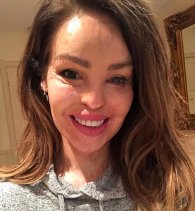 Katie Piper