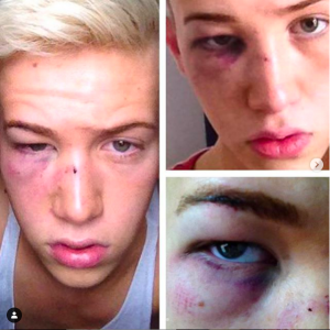 (Credit: bradleyhuntuk Instagram)