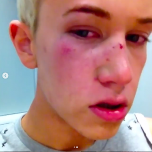 (Credit: bradleyhuntuk Instagram)