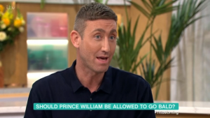 Chris Maloney This Morning hair loss