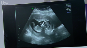 Victoria has her 12 week scan Emmerdale