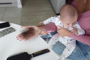 Tyla's hair falls out