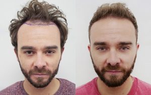 Jack P Shepherd
