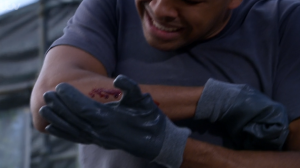 Ellis cut his arm on a nail Emmerdale