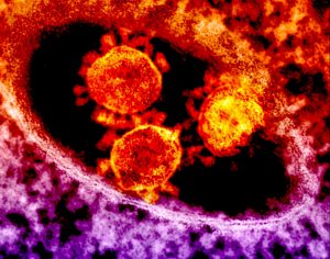 Coronavirus
