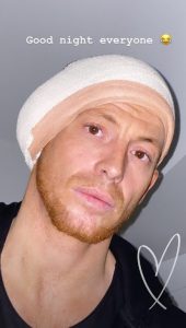 Joe Swash arrives home with bandage around his head