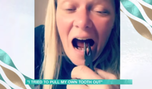 Woman tries to pull tooth out