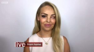 Katie Piper on The One Show