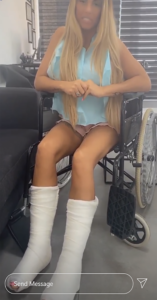Katie Price broken feet