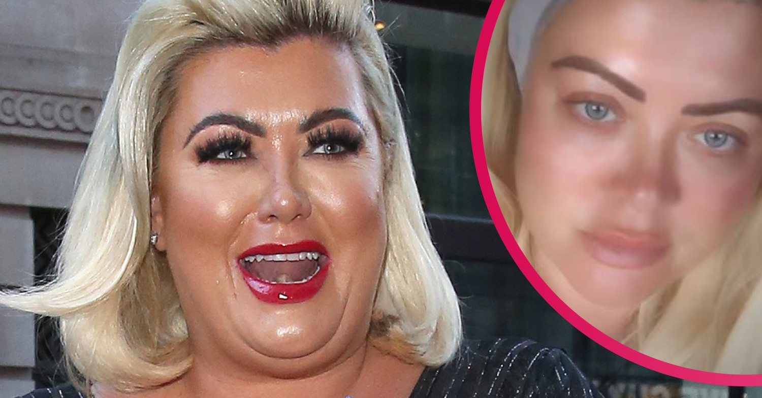 gemma collins skin