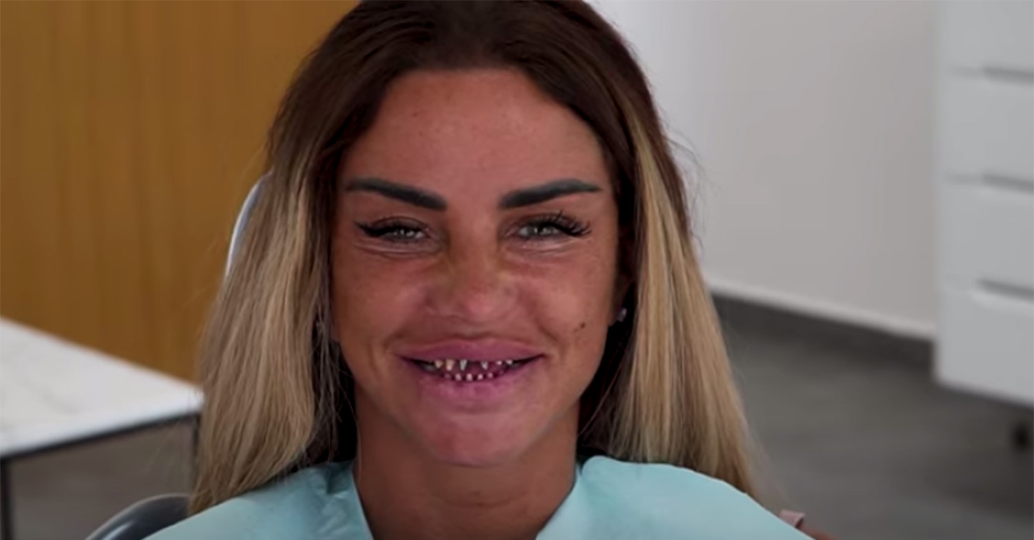 katie price natural teeth