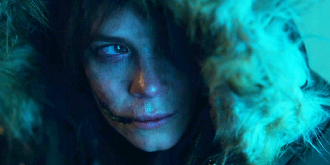 Marcella's scar, where is it from?