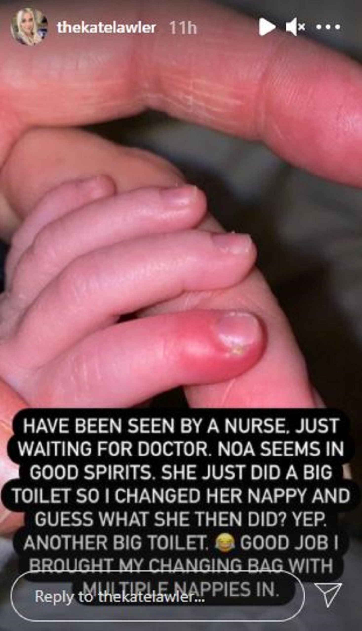 kate lawler baby finger