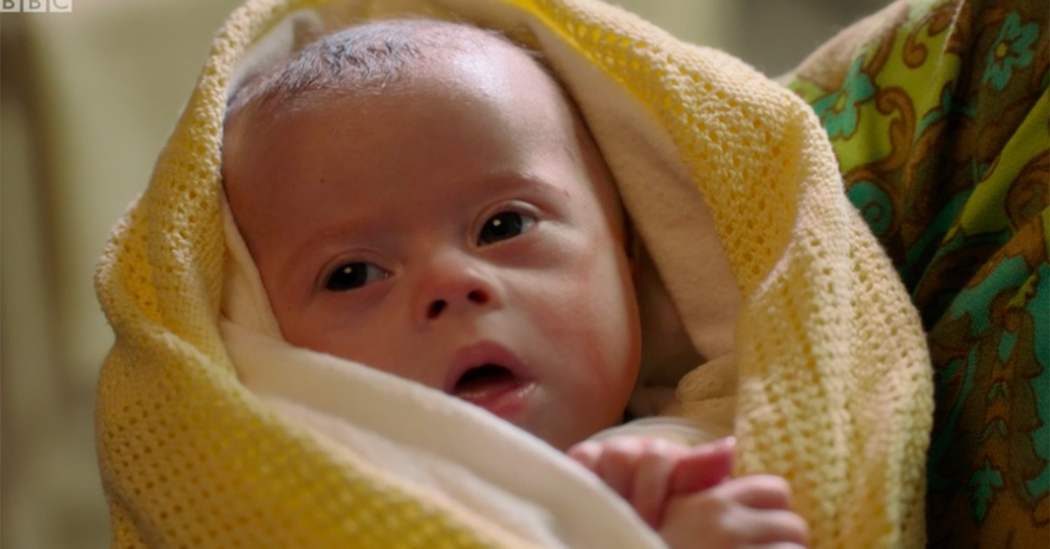 Call The Midwife season 10 finale - Down Syndrome baby