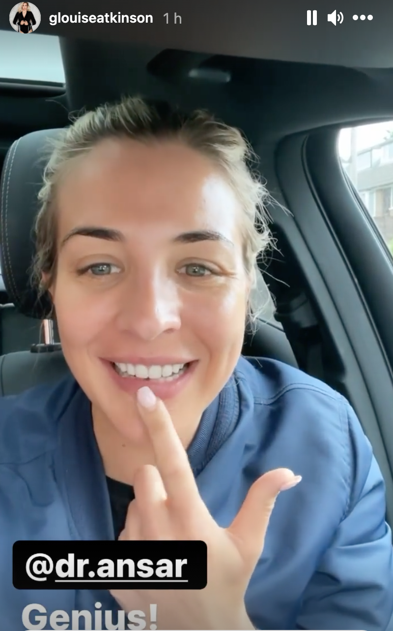 Gemma Atkinson on Instagram showed off her new teeth