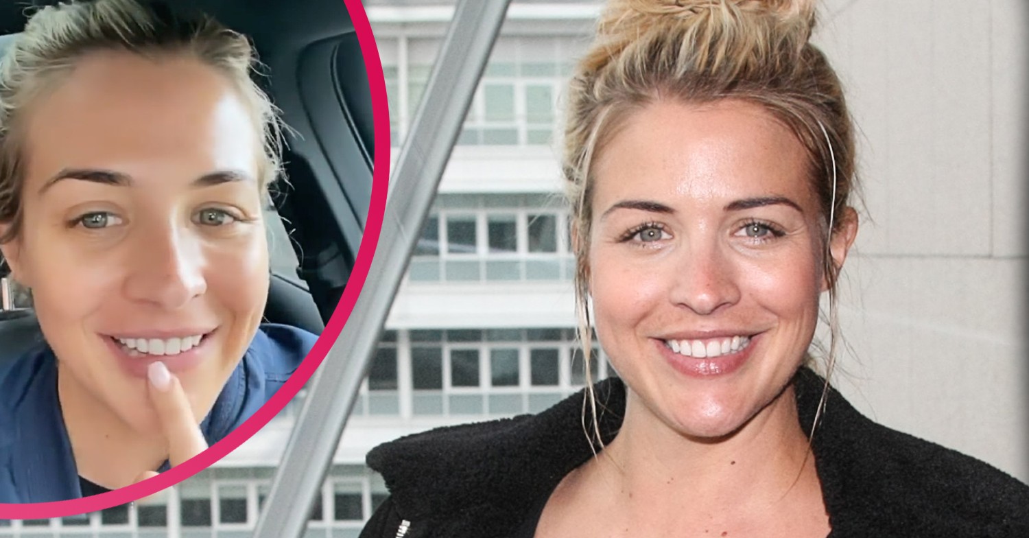 Gemma Atkinson on Instagram showed off her new teeth