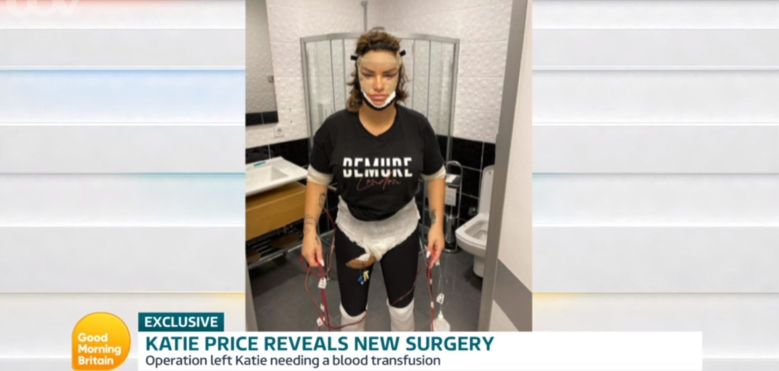 Katie Price surgery