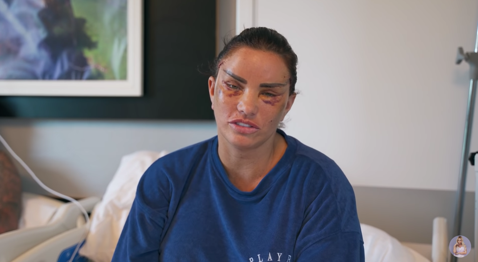 In the latest Katie Price news, the star is selling exclusive footage of her recent cosmetic surgery