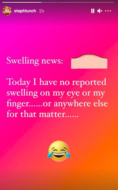 Steph McGovern updates her fans on hand injury