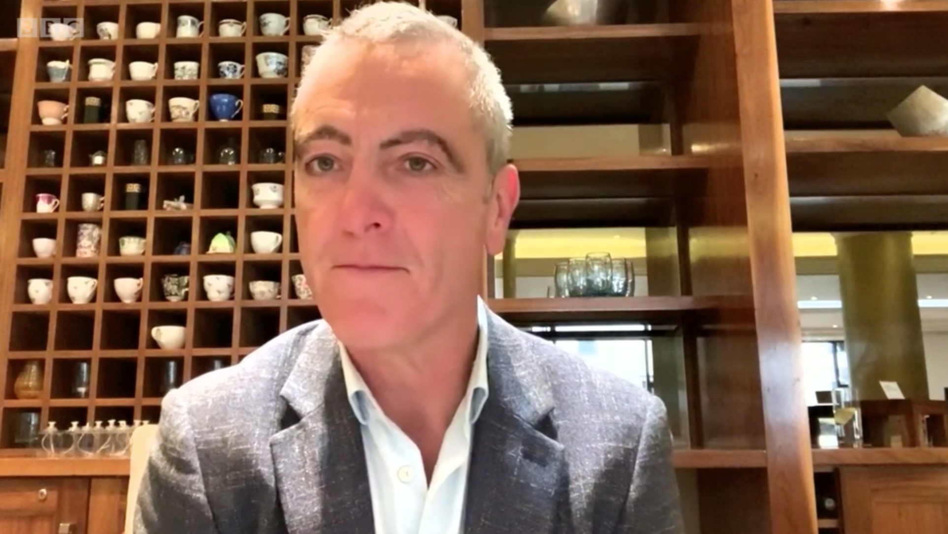 James Nesbitt displayed some curious eyebrows on The One Show