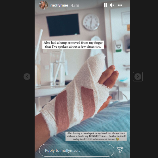 Molly-Mae Hague's bandaged hand after she had a lump removed
