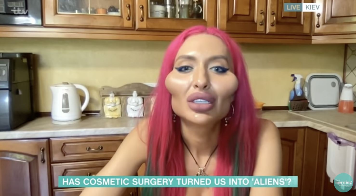 This Morning guest addicted to fillers