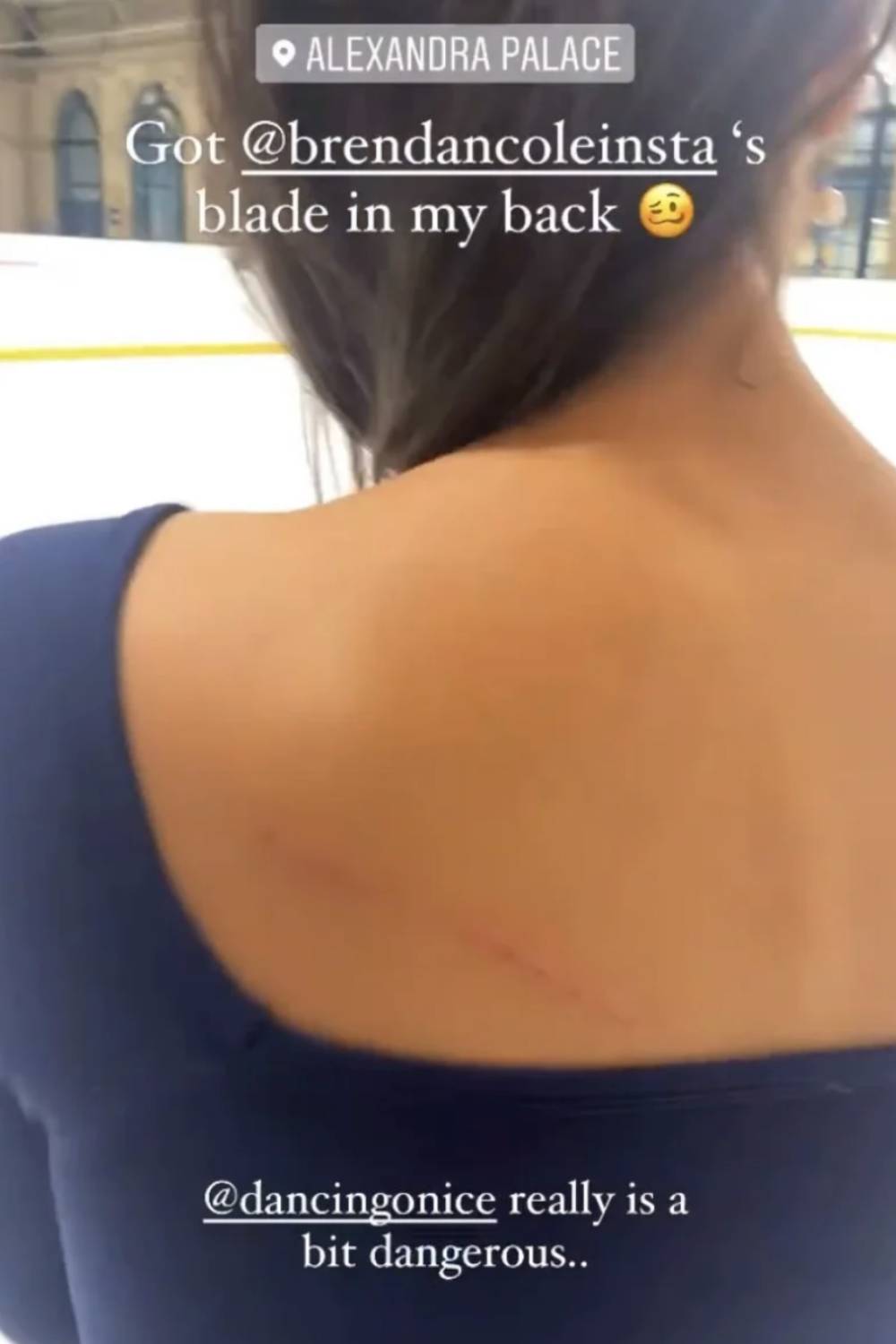 Vanessa posts about her own injury
