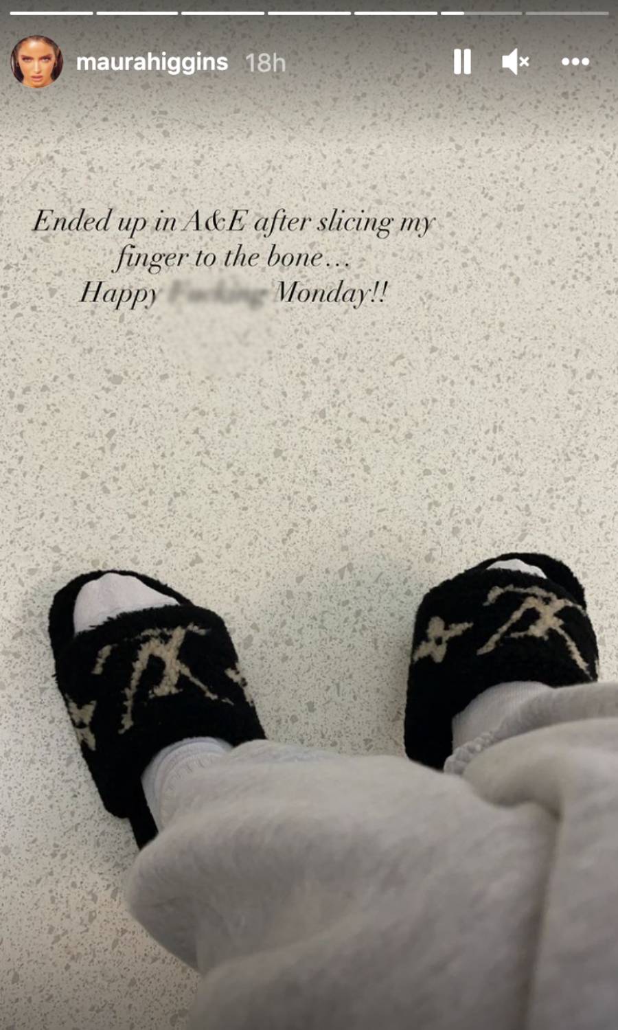 Maura Higgins documents her hospital visit on Insta Stories