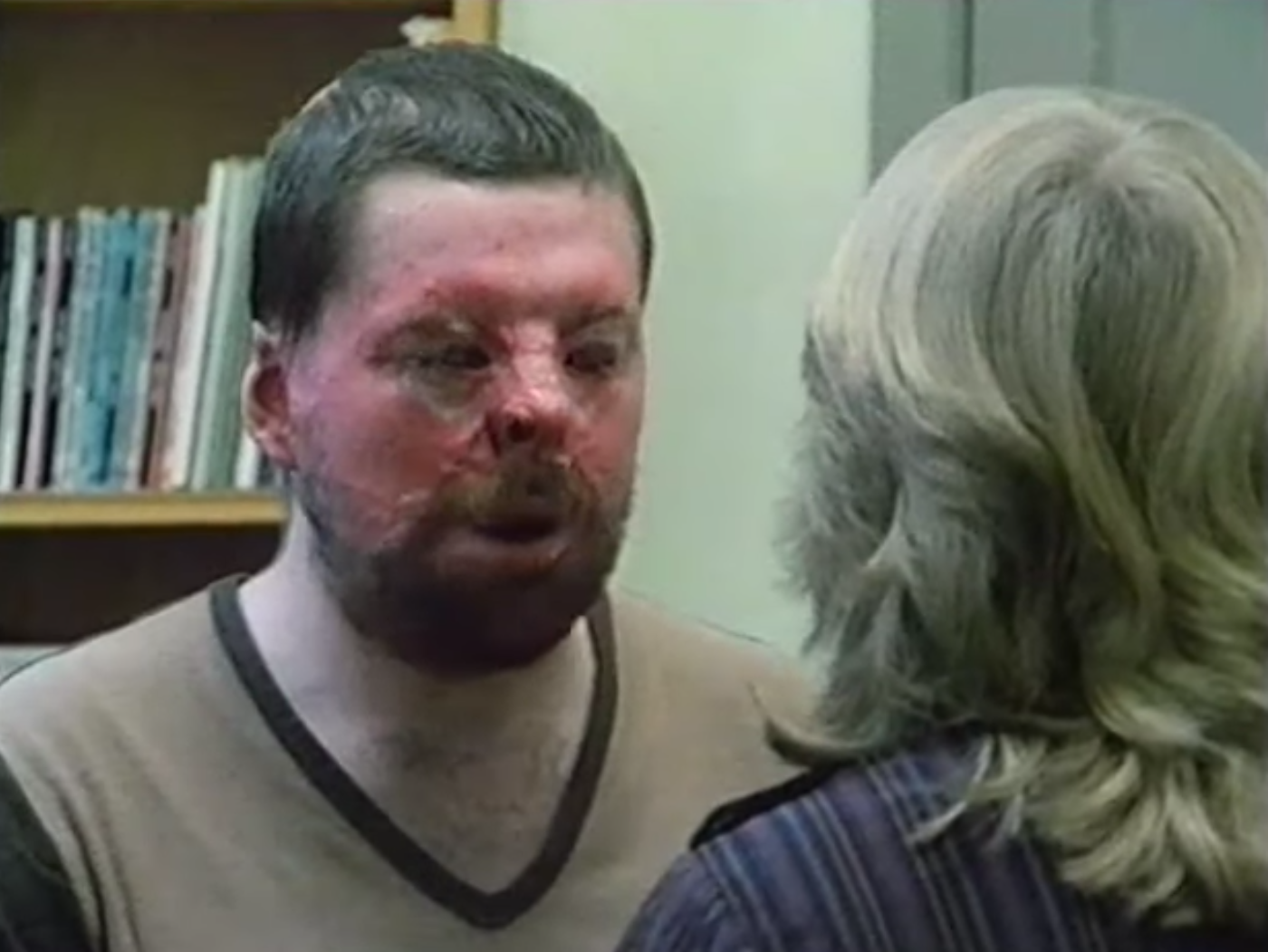 Beat The Chasers star Simon Weston sustained life-changing injuries in the Falklands War