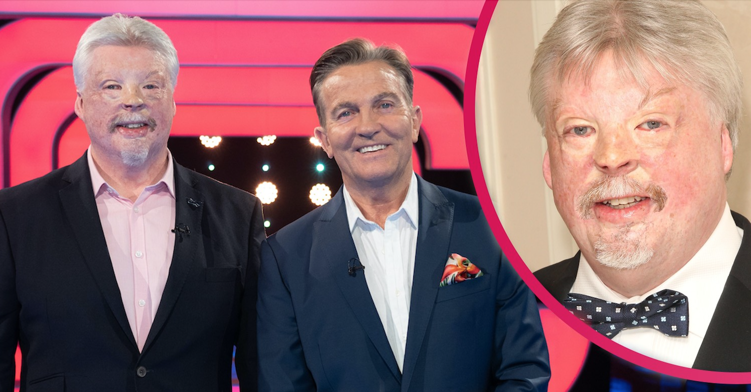 Beat The Chasers star Simon Weston sustained life-changing injuries in the Falklands War