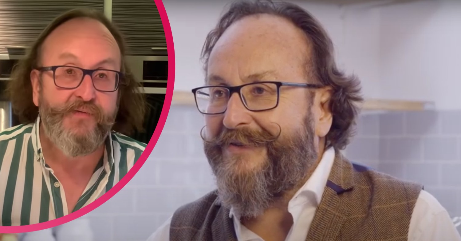 Hairy Bikers star Dave Myers' alopecia battle 'after being brought on by his mum's illness'