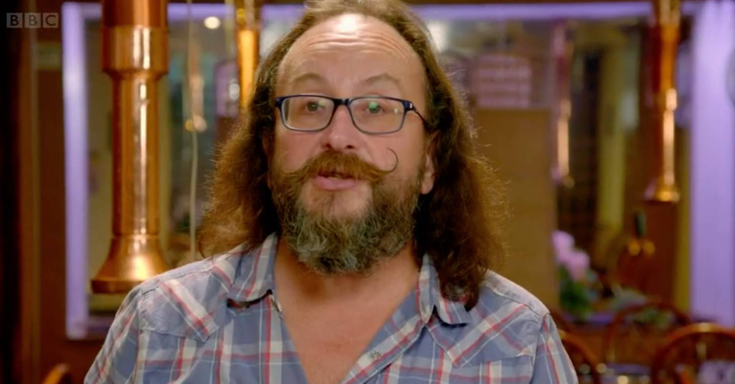 Dave Myers: His hair loss developed into alopecia when he was 14