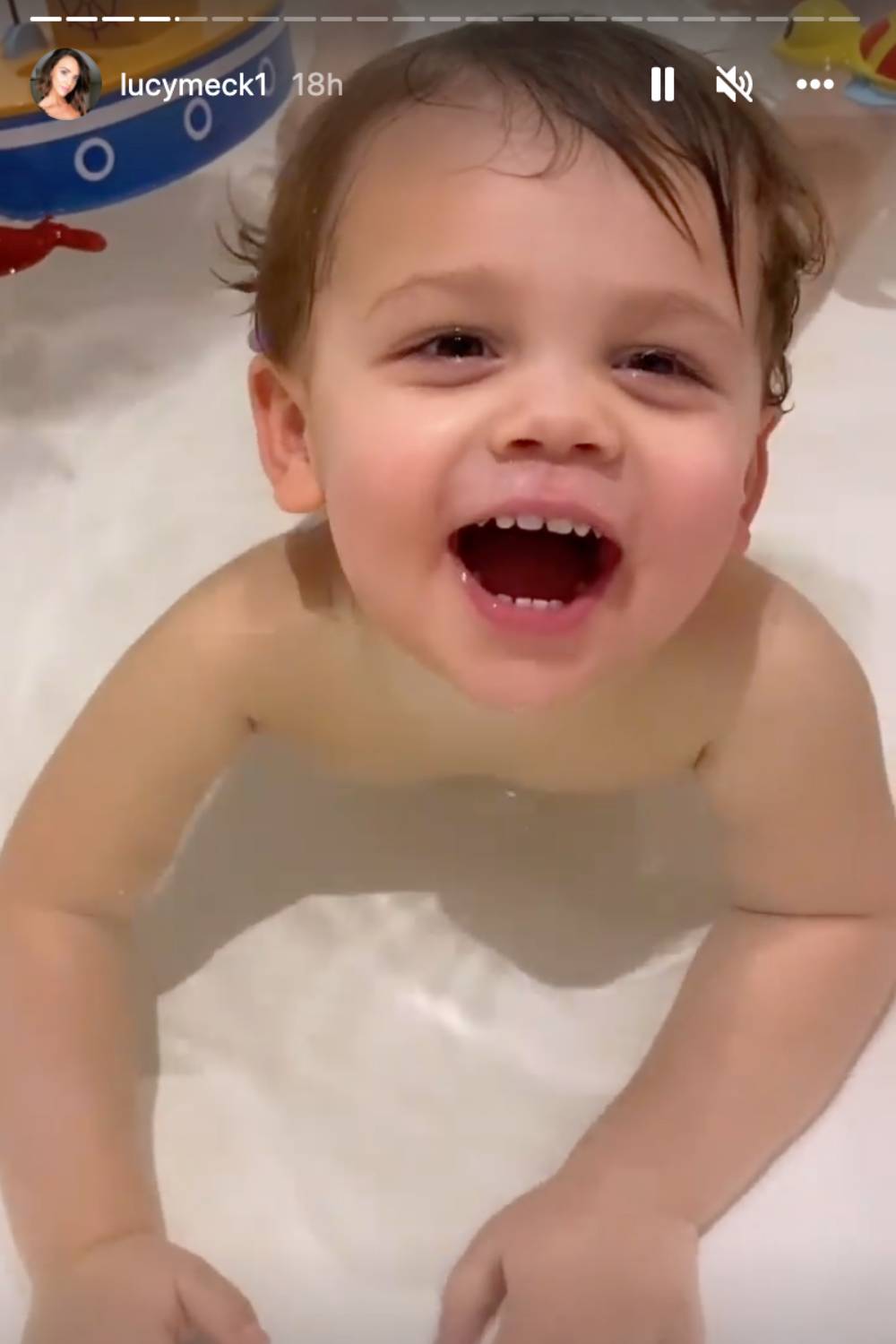 Roman recently underwent a videofluoroscopy