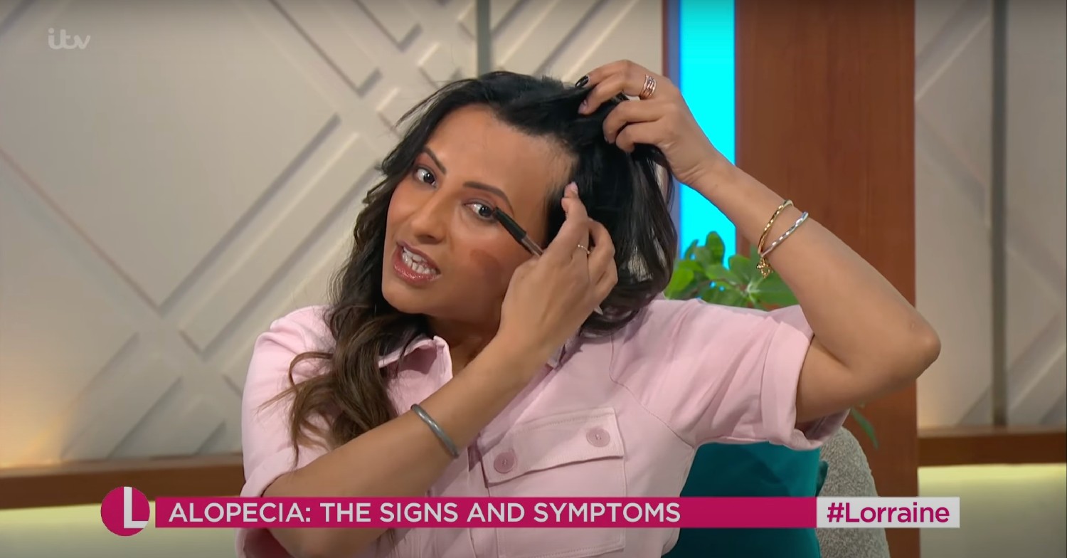 Ranvir Singh showing her hair loss due to alopecia on Lorraine