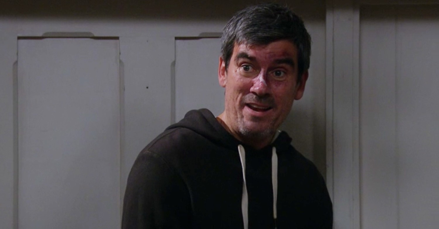 Cain Dingle looking serious on Emmerdale