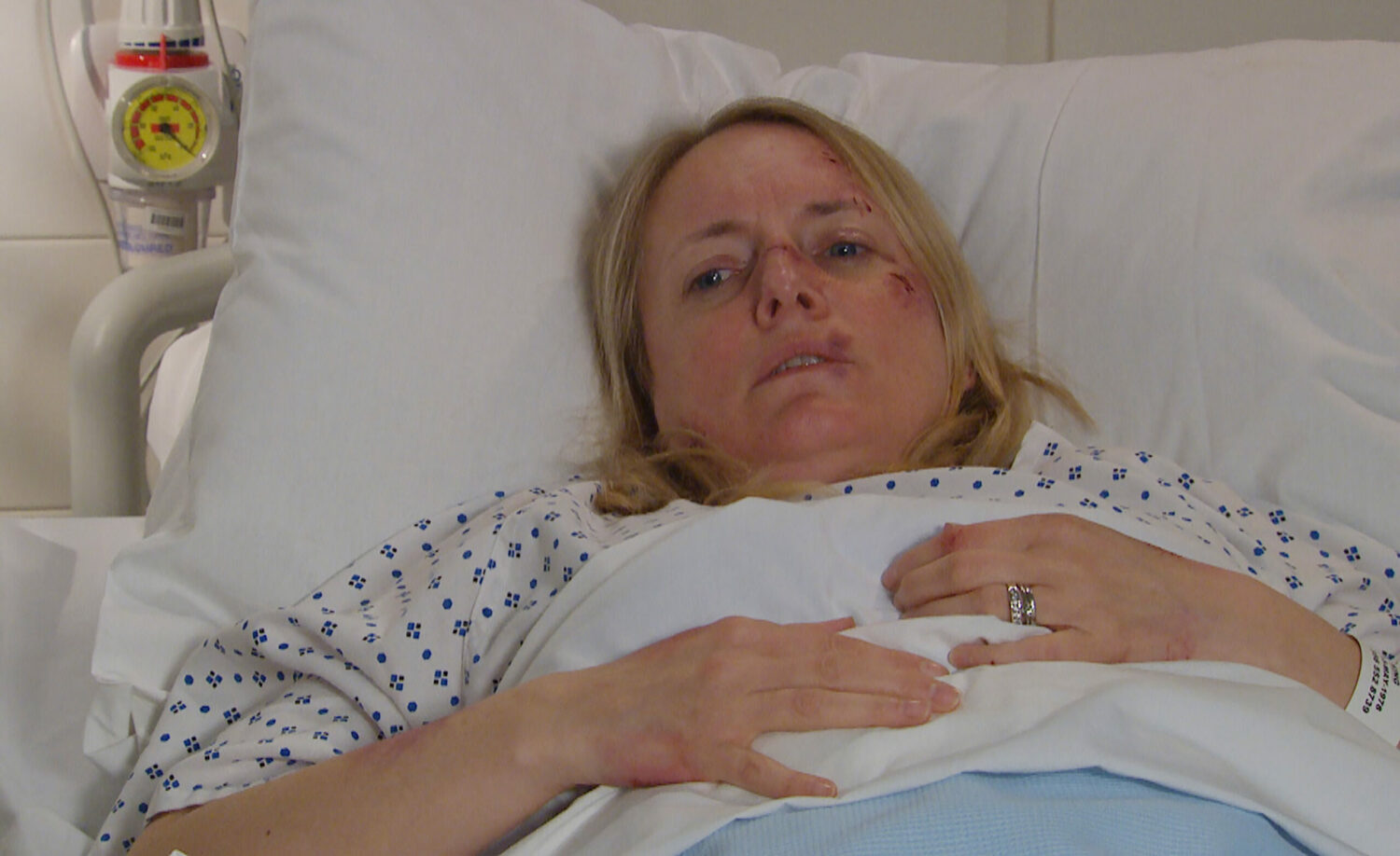 Terrified Nicola lies beaten and bruised in a hospital bed in Emmerdale