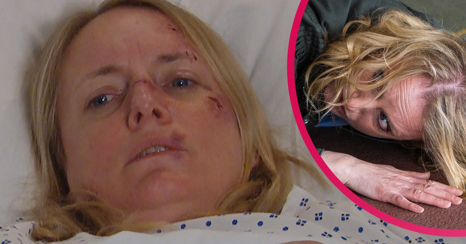 NIcola in hospital split image with being attacked