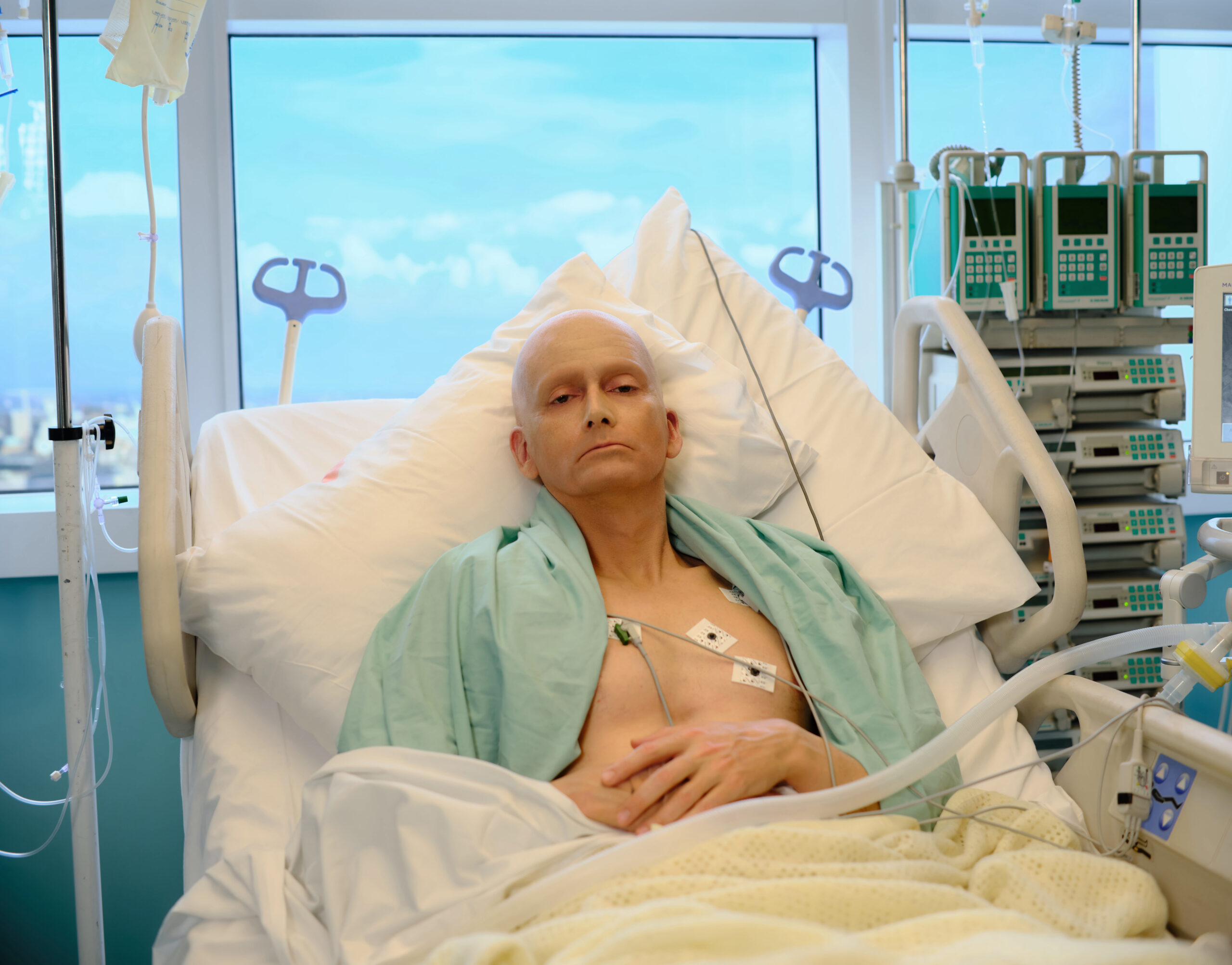 A bald David Tennant in character as LITVINENKO on ITVX