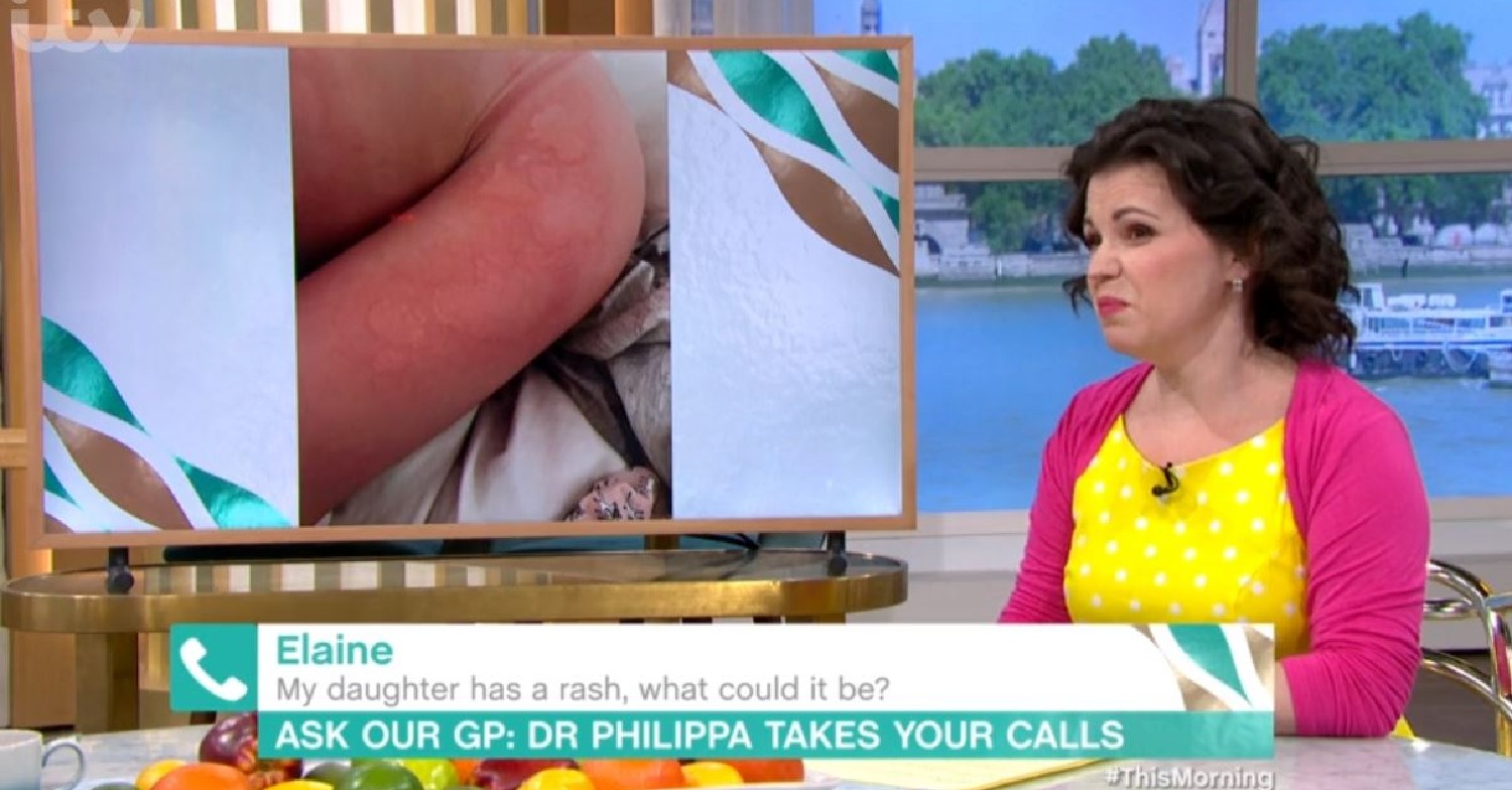 Dr. Phillipa Kaye pulling a face next to a picture of a rash during her appearance on This Morning today