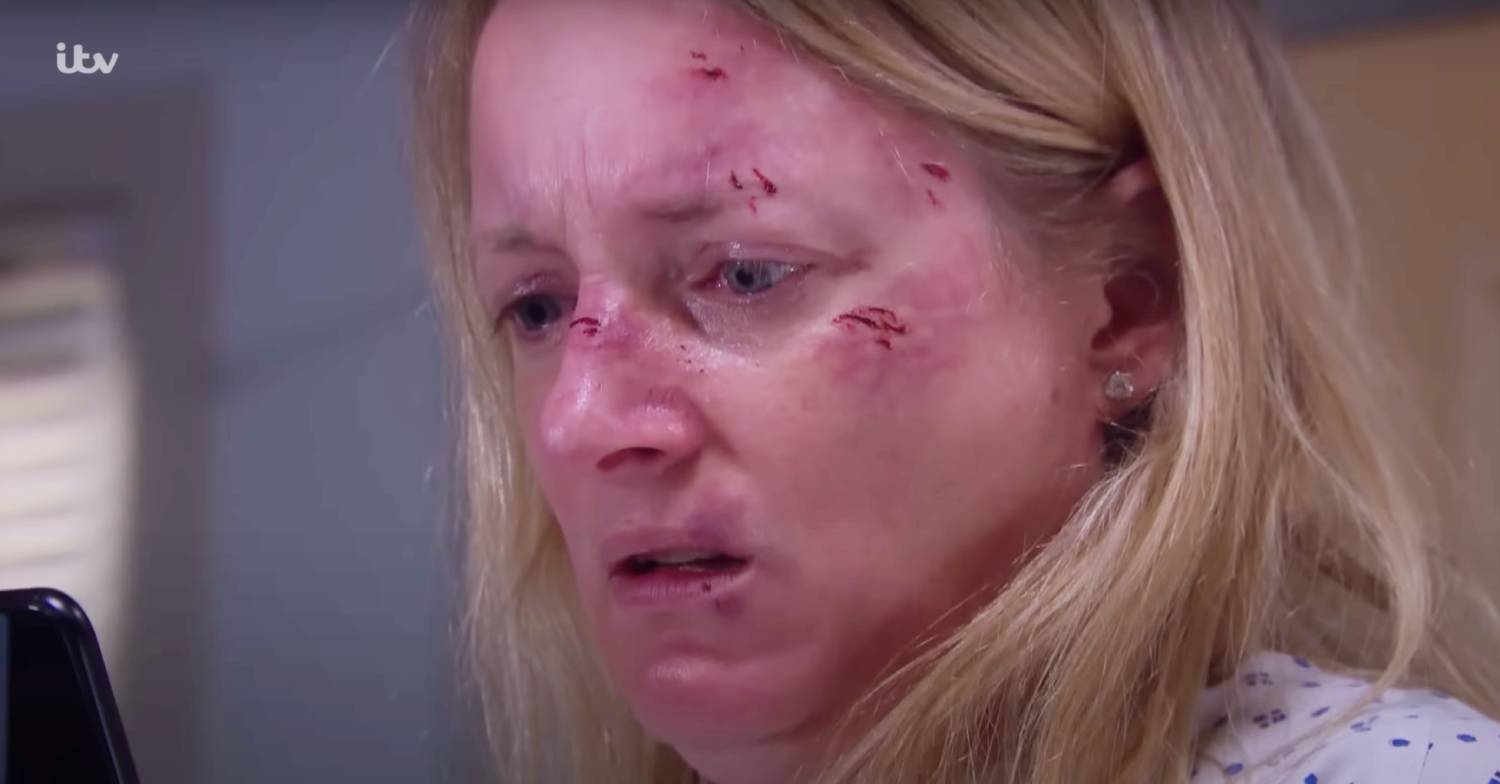 Nicola is horrified to realise on Emmerdale that footage her attack in online