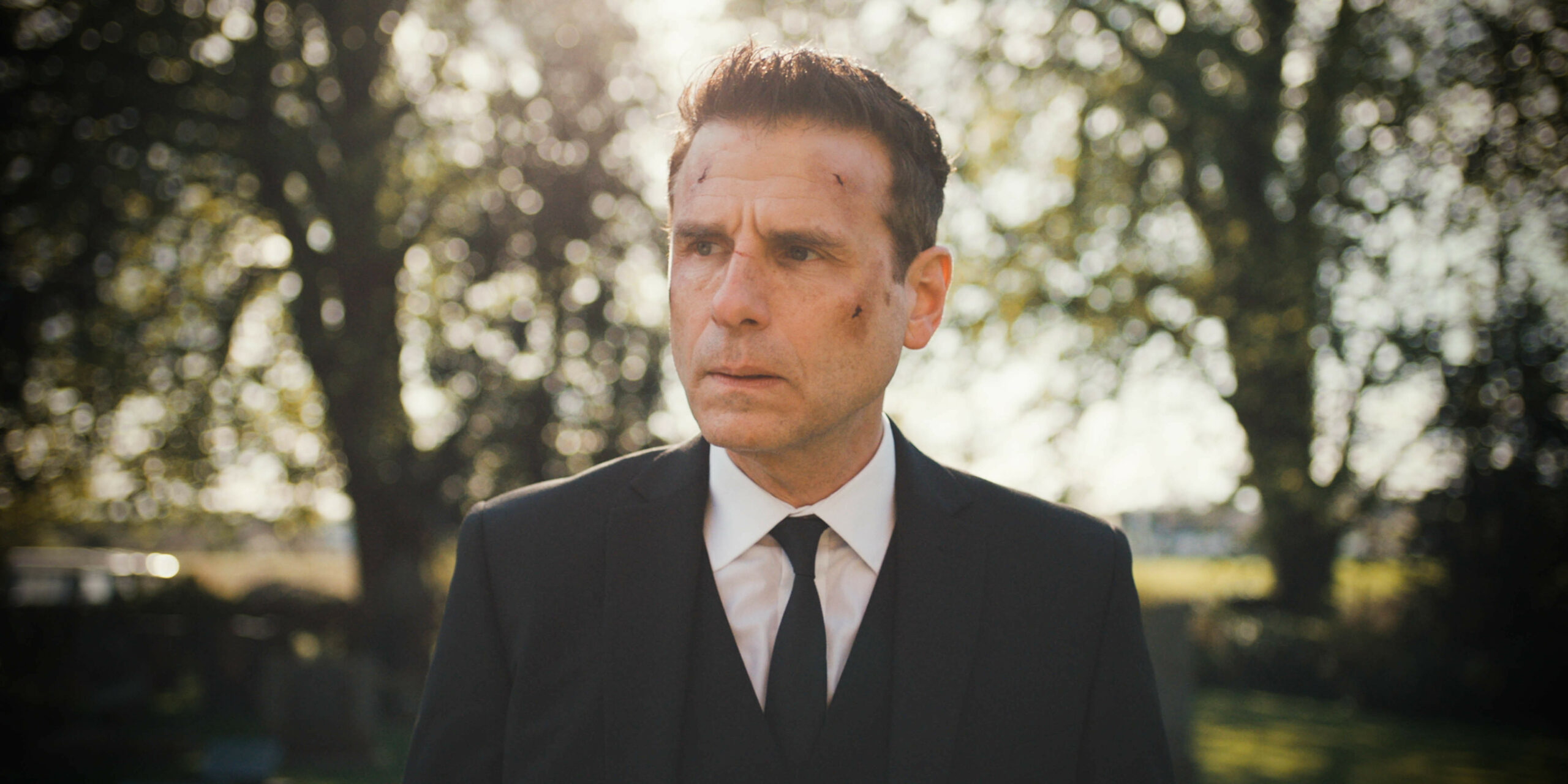 Battered and bruised David looks upset